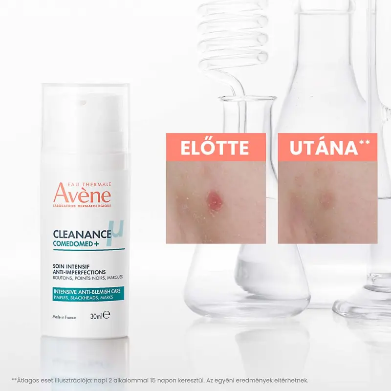 Cleanance Comedomed+ Intenzív ápoló 30 ml