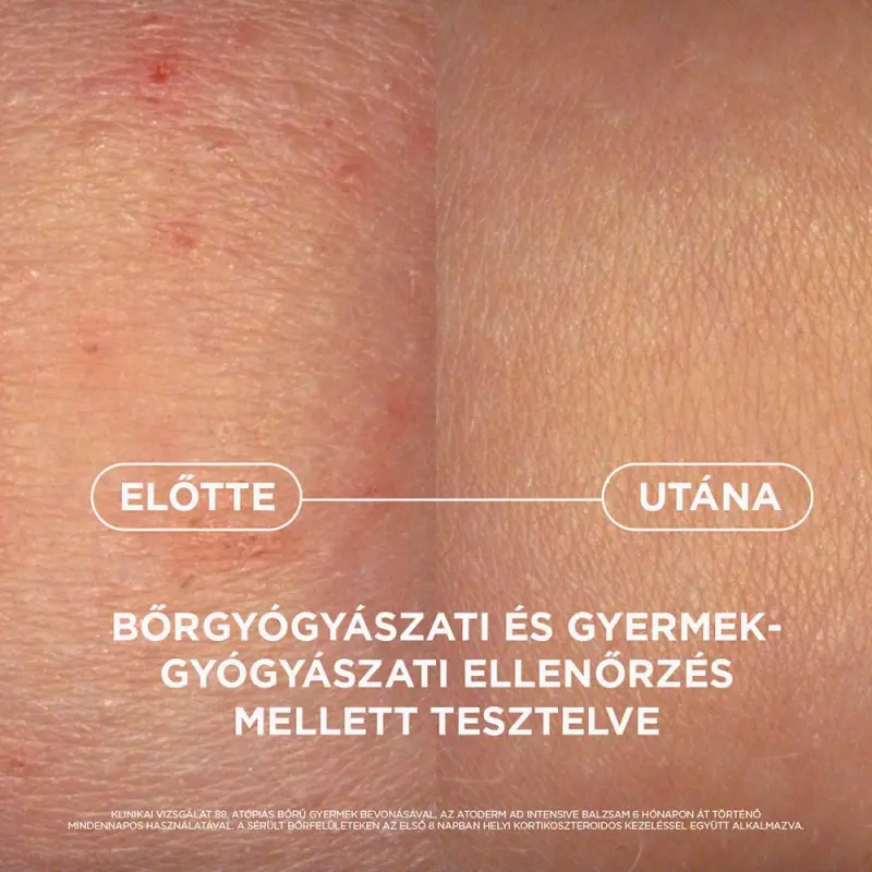 Atoderm AD Intensive Balzsam 75 ml
