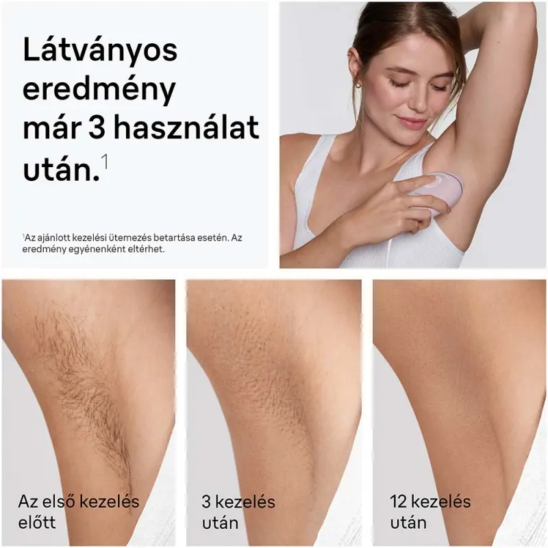 Silk-expert IPL PL1111 Villanófényes szőrtelenítő