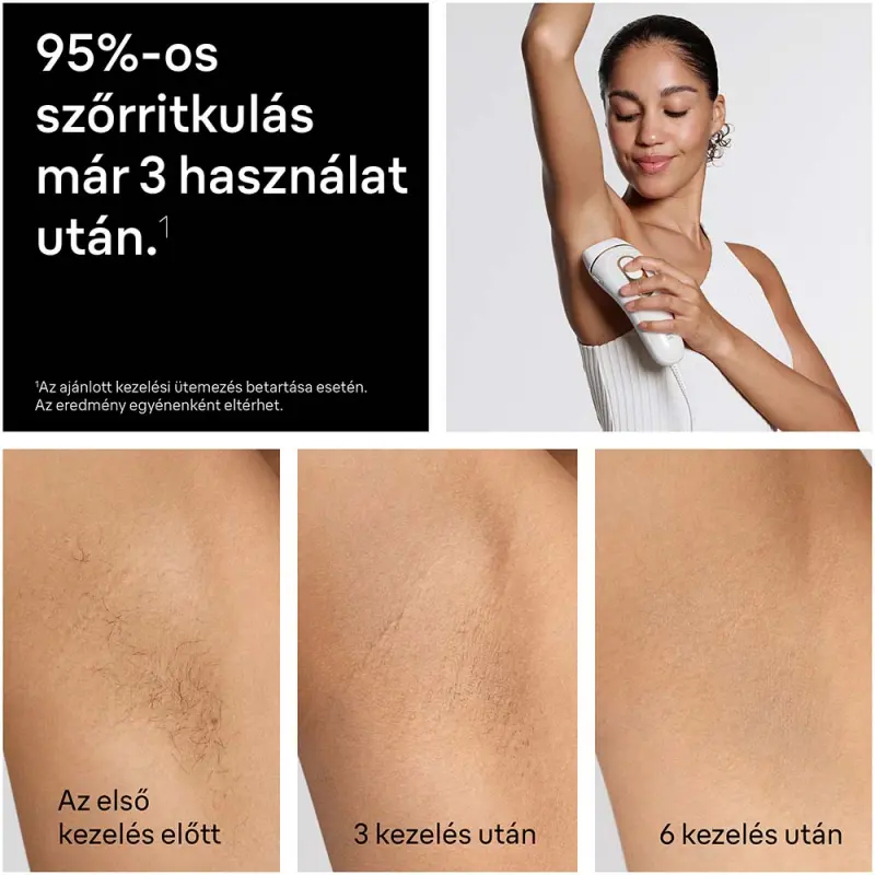 Silk-expert IPL PL5210 Villanófényes szőrtelenítő