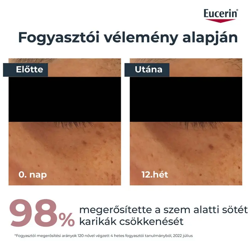 Anti-Pigment Szemránckrém 15 ml