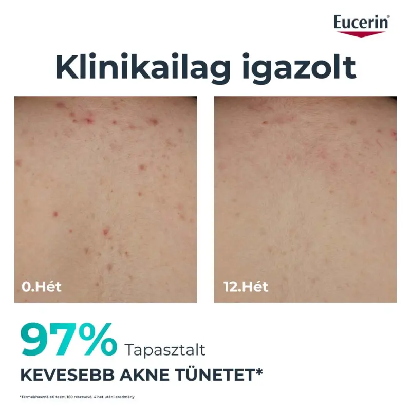 DermoPure Clinical Correcting Body Care - Testkrém 200 ml