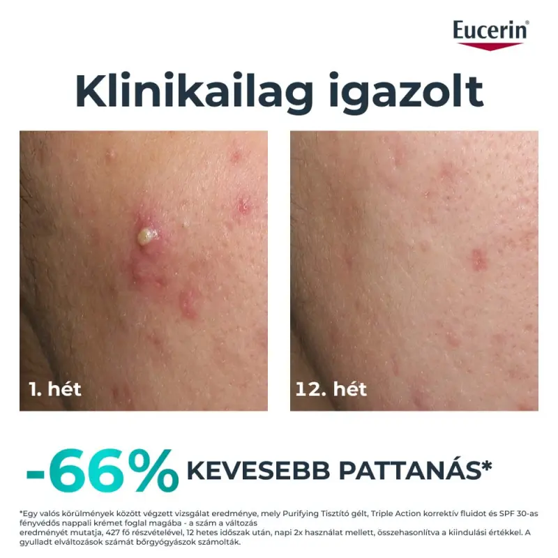DermoPure Clinical Triple Action - Korrektív Fluid 40 ml