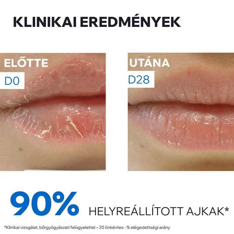BARIÉDERM CICA ajakápoló balzsam 15 ml