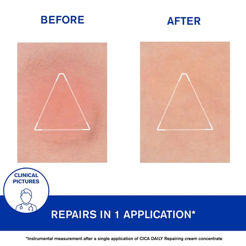 Bariéderm CICA DAILY Regeneráló arcápoló koncentrátum krém 50 ml